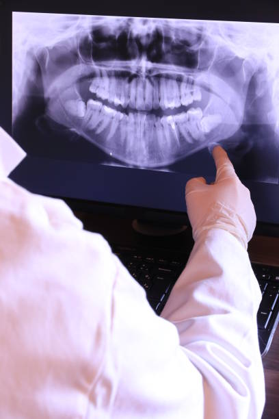 Best Teeth Whitening  in Steilacoom, WA